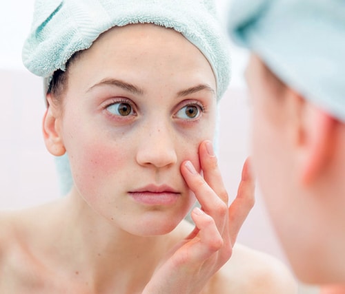 Sự thật sử dụng dưỡng mi feg bị thâm mắt