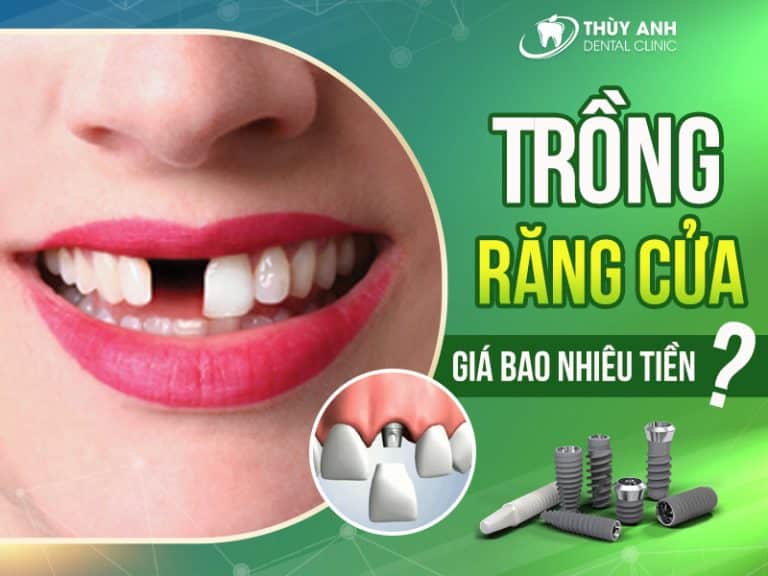 trong rang cua gia bao nhieu 2 768x576 1