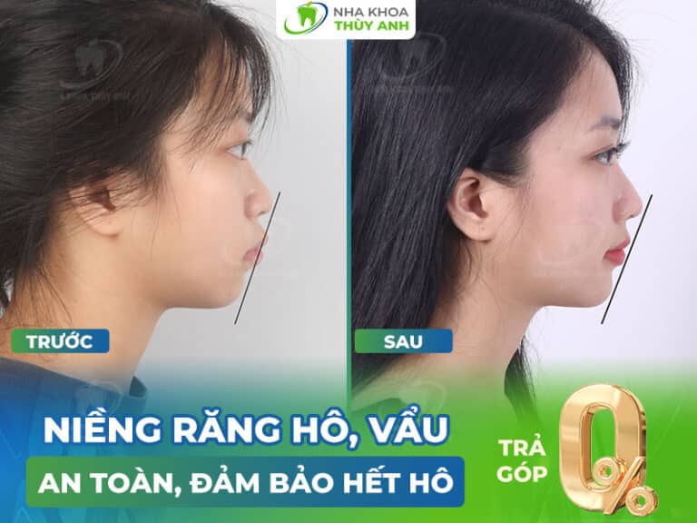 nieng rang ho vau an toan 768x576 1