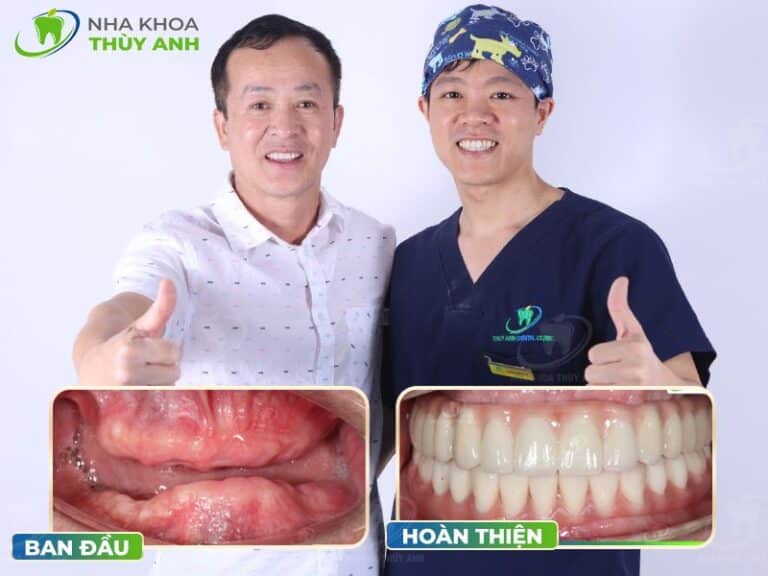 bac si cay implant gioi 3 768x576 1