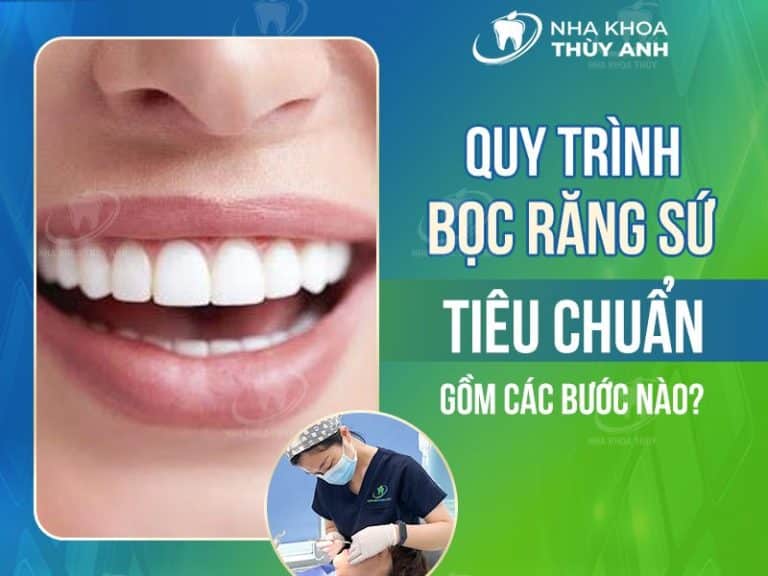 quy trinh boc rang su 768x576 1