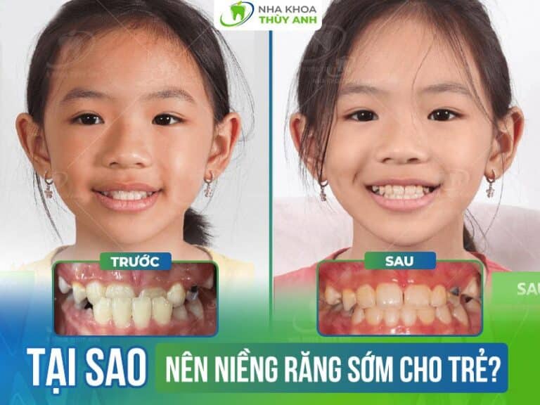 nieng rang cho tre em som 768x576 1