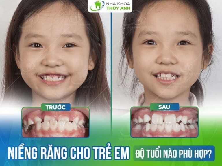 nieng rang cho tre em som do tuoi nao